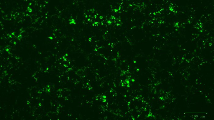Na zdjęciu komórki HEK293T produkujące białko fuzyjne CD63-GFP (białko markerowe egzosomów CD63 z zielonym białkiem fluorescencyjnym)